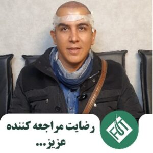 آیا کاشت مو درد دارد؟ توضیحات مراجعه کننده عزیز