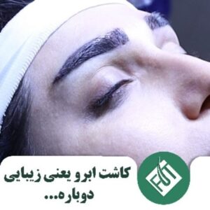 کاشت ابرو یعنی زیبایی دوباره