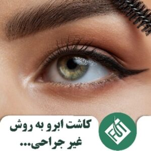 کاشت ابرو ب روش غیر جراحی2