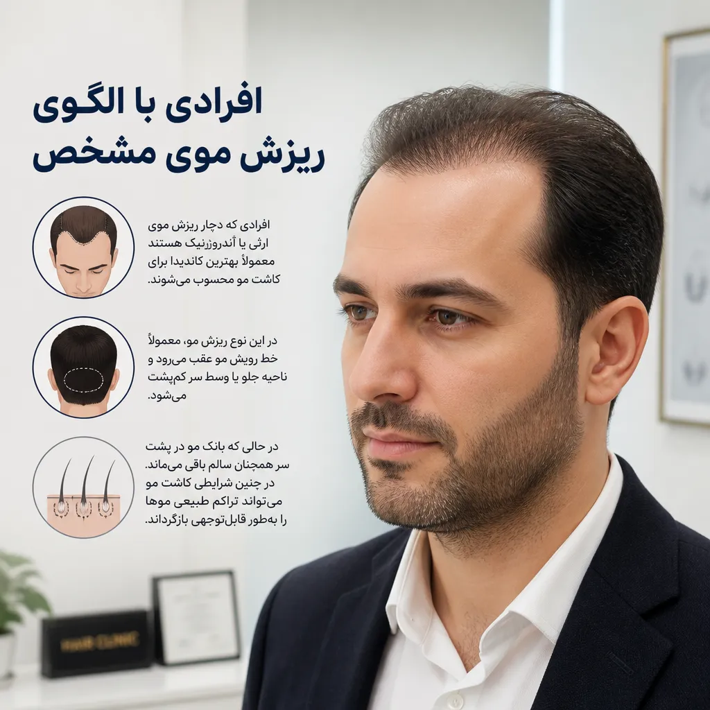 افرادی با الگوی ریزش موی مشخص