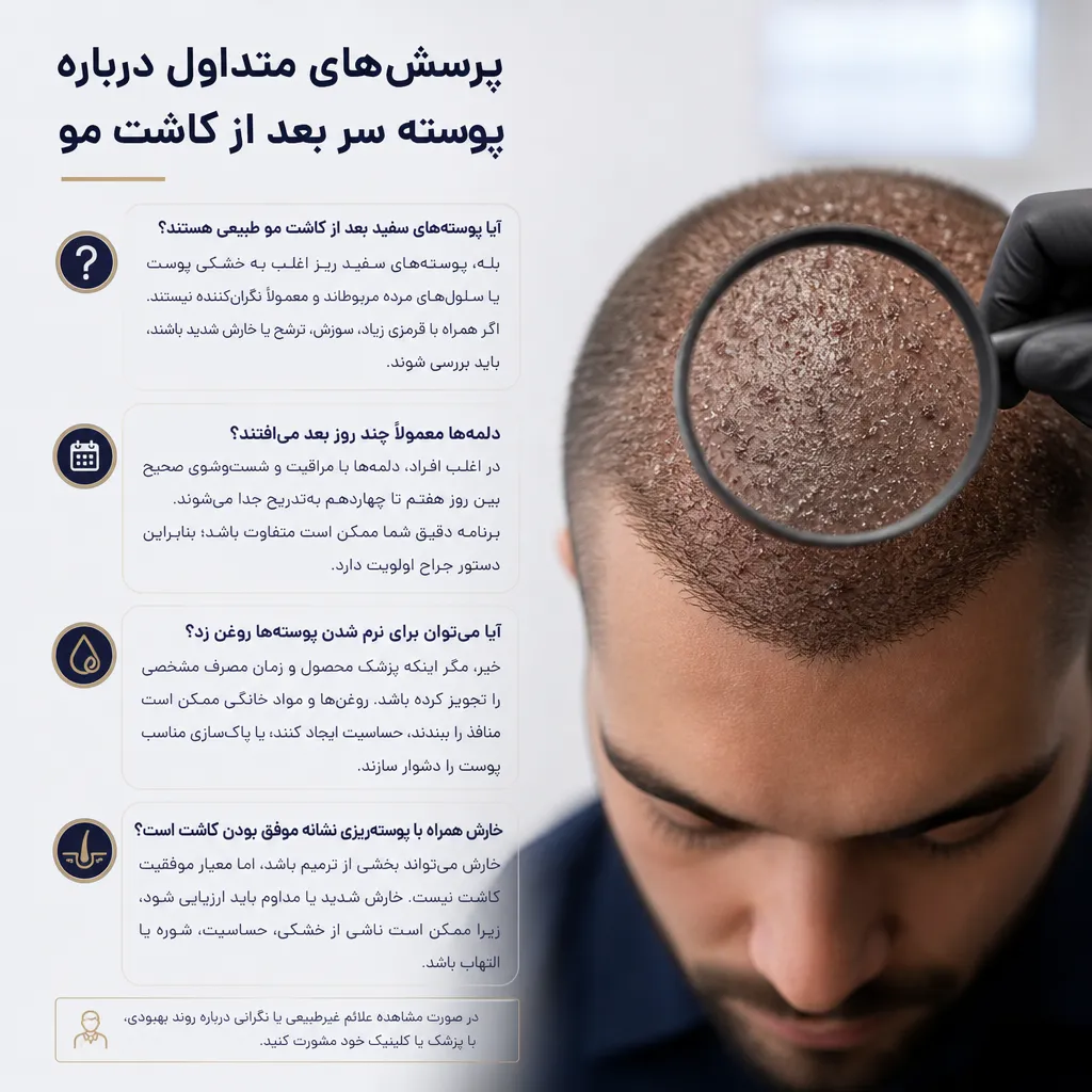 پرسش‌های متداول درباره پوسته سر بعد از کاشت مو