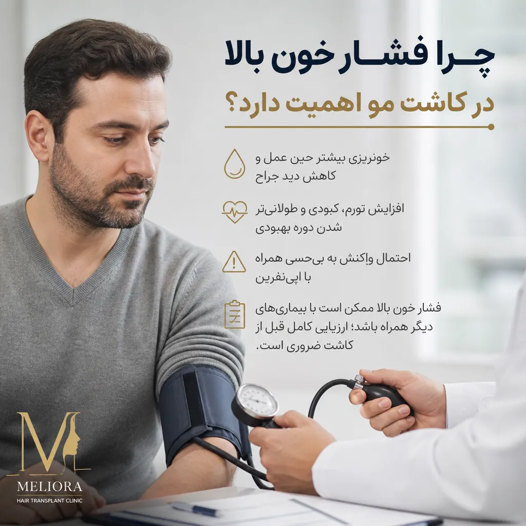 شرایط کاشت مو برای افراد مبتلا به فشار خون بالا 2 چرا فشار خون بالا در کاشت مو اهمیت دارد؟